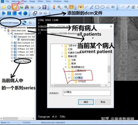 dicom格式和dcm一样吗？dcm文件怎么打开-图1