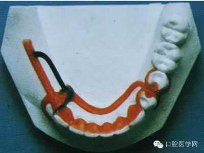 弹性分组环传输方式（弹性连接的卡环）-图2