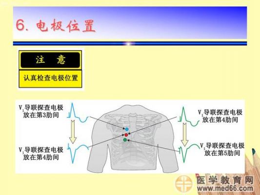 心电结果怎么传输（心电怎么连接）-图3