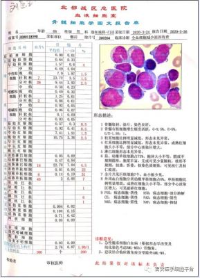 急性髓系白血病M4，能治好吗？m4m