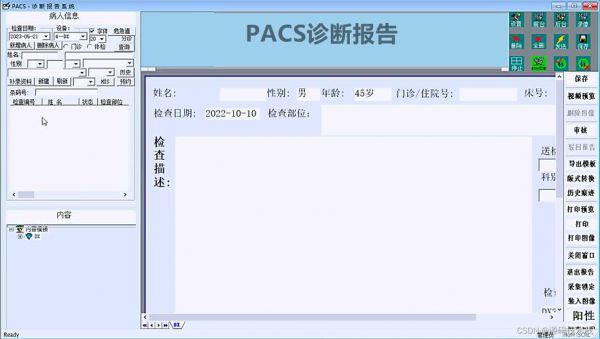 pacs传输数据（从pacs网络传输dicom文件）-图3